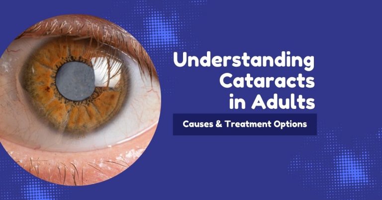 Understanding Cataracts in Adults