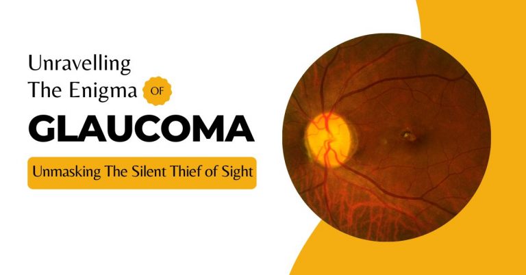 A Comprehensive Guide to Glaucoma in Adults