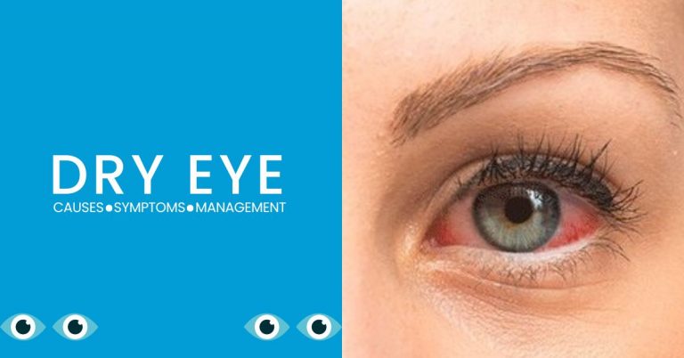 Dry Eye