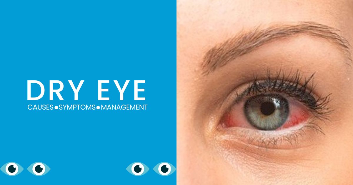 Dry Eye